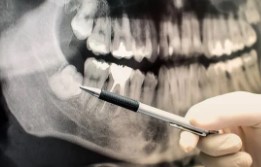 xray